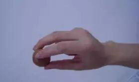 儿童发育迟缓康复训练——小儿脑瘫的作业疗法训练